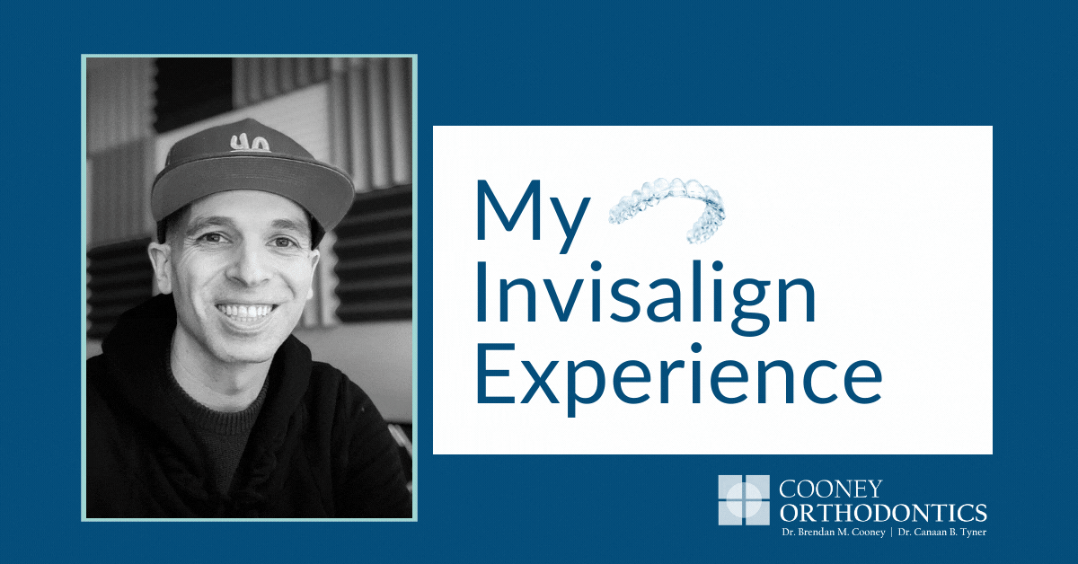 Invisalign Patient Experience: Q&A